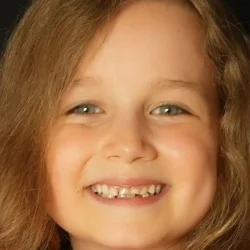 Melisa Duru Ünal