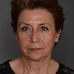 Serra Menderes